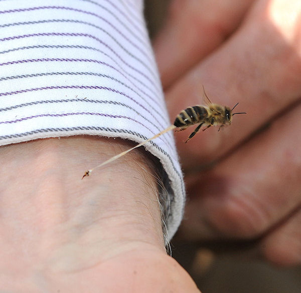 photo humour insolite piqûre abeille