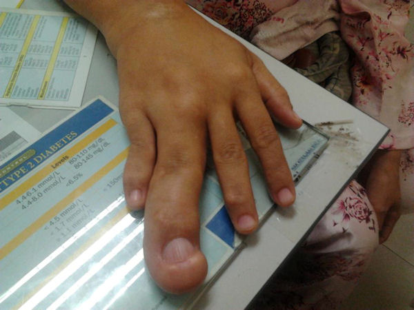 insolite auriculaire doigt main