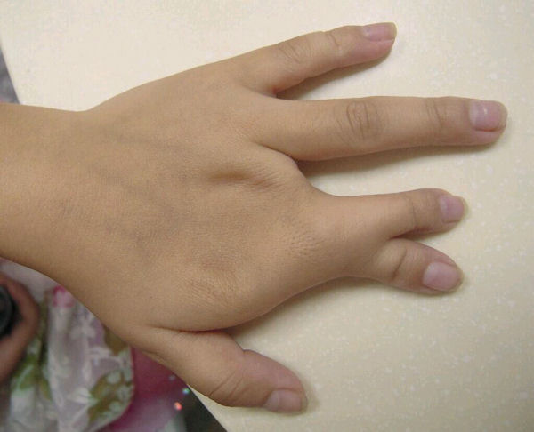 insolite doigt main