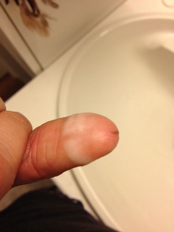 insolite pansement penis pouce