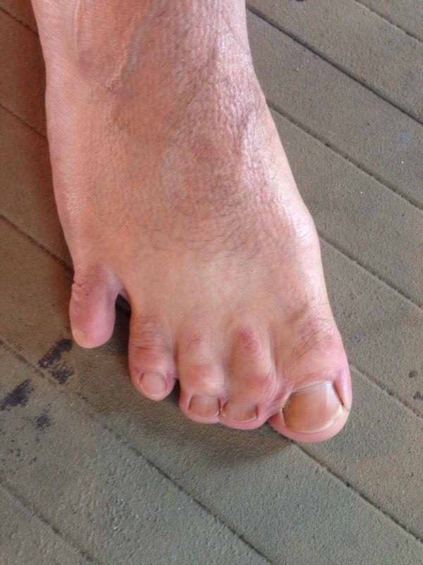 insolite orteil pied