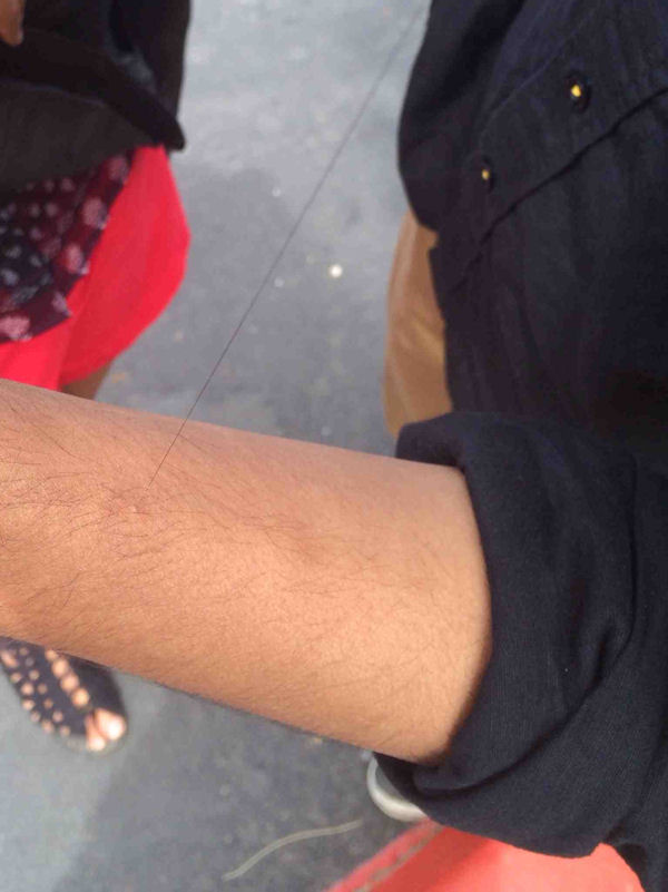 insolite bras long poil