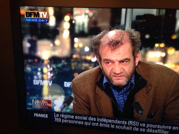 insolite guerison pouvoir wolverine