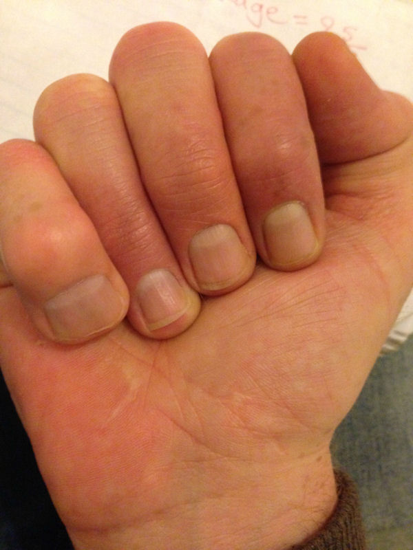 insolite doigt gros main petit