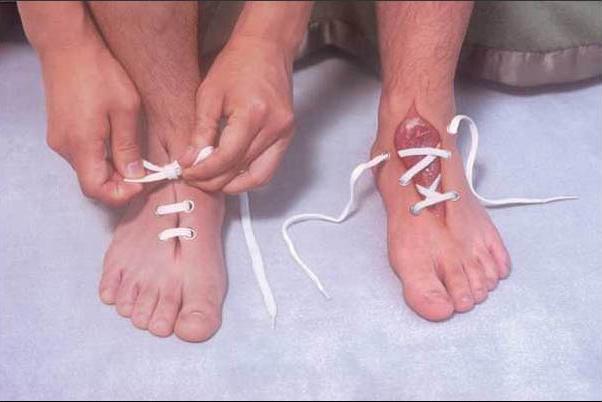 trucage insolite lacet dans la peau du pied