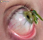 oeil Un insecte sur un oeil