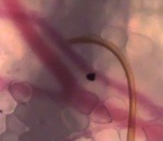 sang Vue au microscope d'un moustique qui cherche du sang