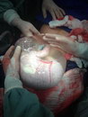sac bebe Un nouveau-né dans sa poche amniotique