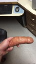 penis Patate pénis