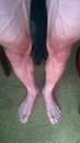jambe Les jambes d'un coureur du Tour de France