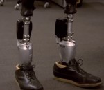 jambe prothese Des chevilles bioniques