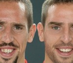 franck Franck Ribéry relooké sur Photoshop