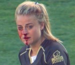 sang femme Une rugbywoman se casse le nez, se relève et plaque deux adversaires