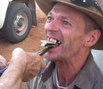 dent arracher Technique australienne pour arracher des dents
