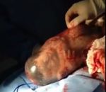 naissance bebe Un bébé est né dans son sac amniotique