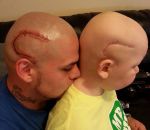 tatouage cicatrice papa Un papa se tatoue la cicatrice de son fils atteint d'un cancer