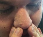 nez doigt Une technique pour enlever les points noirs sur le nez