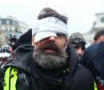 gilet manifestation Jérôme Rodrigues blessé à un œil pendant un live Facebook (Gilets Jaunes Acte 11)