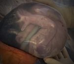 amniotique Un bébé dans sa poche de liquide amniotique