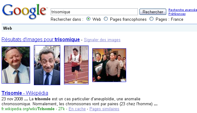 Sarkozy trisomique