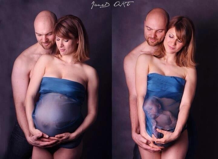 Femme enceinte, pendant et après