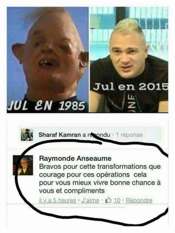 insolite chirurgie cinoque esthetique jul