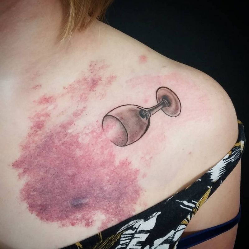 insolite angiome plan tache tatouage verre vin