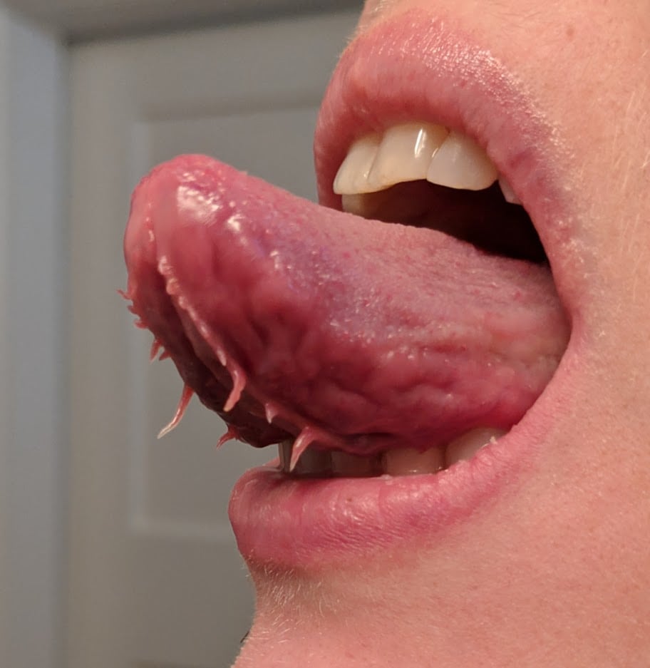 Tentacules sous la langue