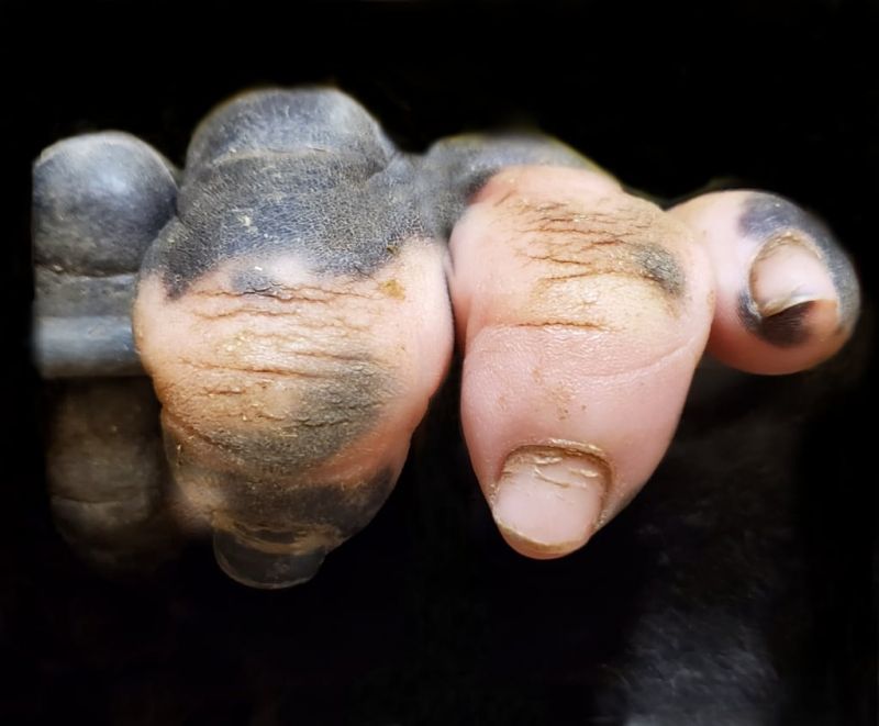 insolite doigt gorille pigmentation