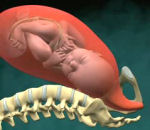 uterus Accouchement en 3D