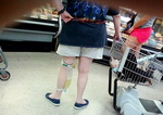 femme jambe urinaire Merci de mettre un pantalon !