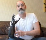 bras Prothèse de bras robotique