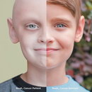 comparaison Noah, survivant du cancer