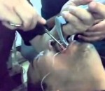 docteur Un Irakien avec un objet insolite dans la gorge 