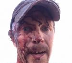 blessure Un chasseur se filme après avoir été attaqué par un ours